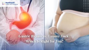 Gastric Bypass Vs. Tummy Tuck: Which Is Right For You?