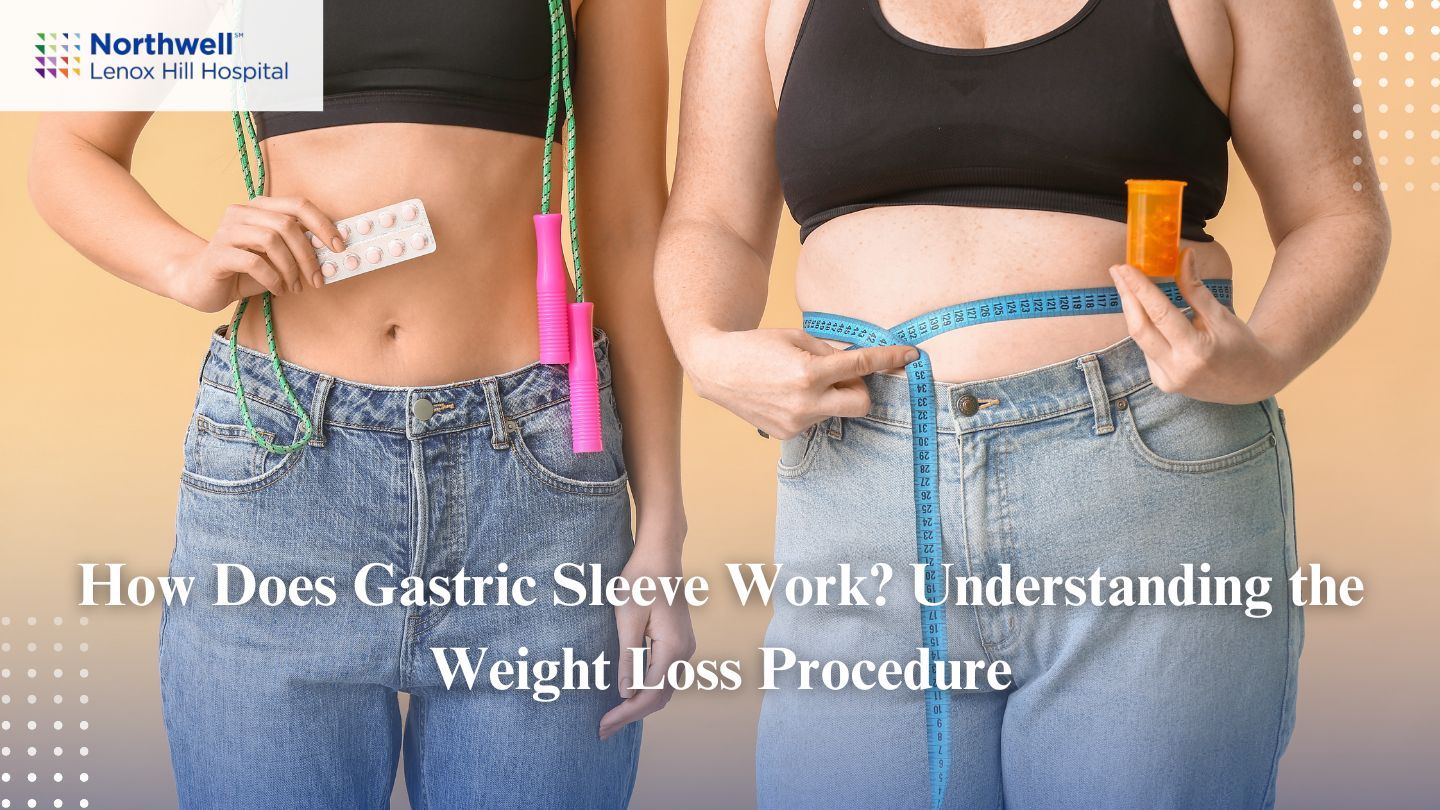 How Does Gastric Sleeve Work? Understanding The Weight Loss Procedure